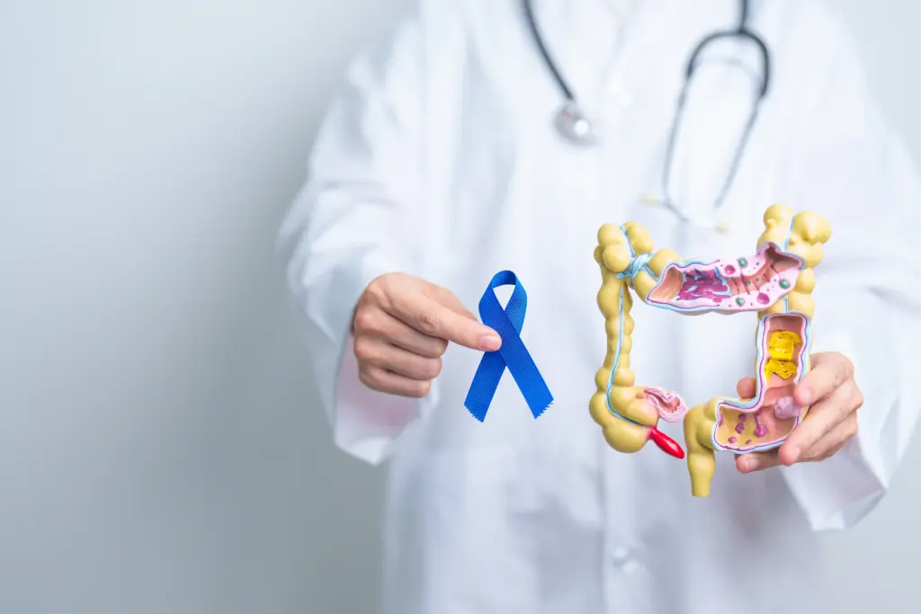 Blood in stool? When to worry about colon cancer 1 Blood in stool? When to worry about colon cancer