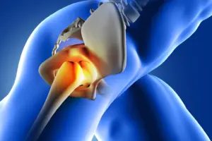 What is a hip labral tear? Symptoms, causes, and treatment