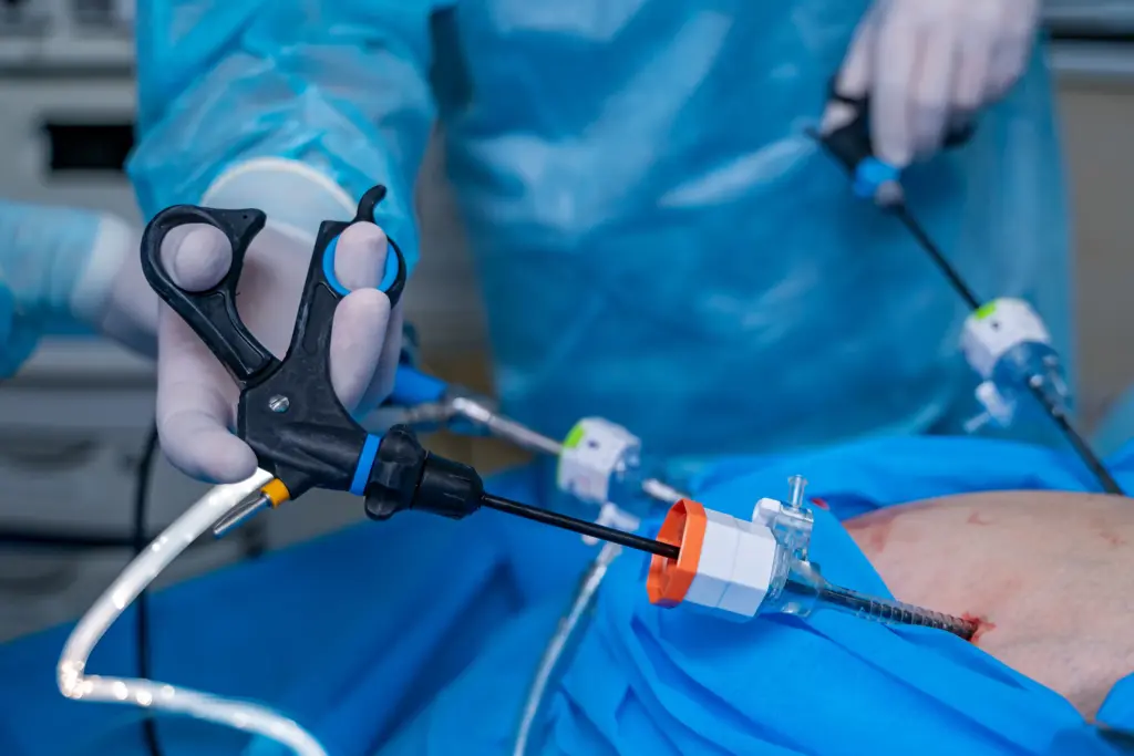 Preparing for laparoscopy: Expectations, scars, and recovery timelines