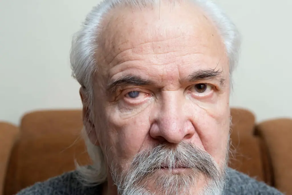 Understanding glaucoma: Risk factors, symptoms, and treatment