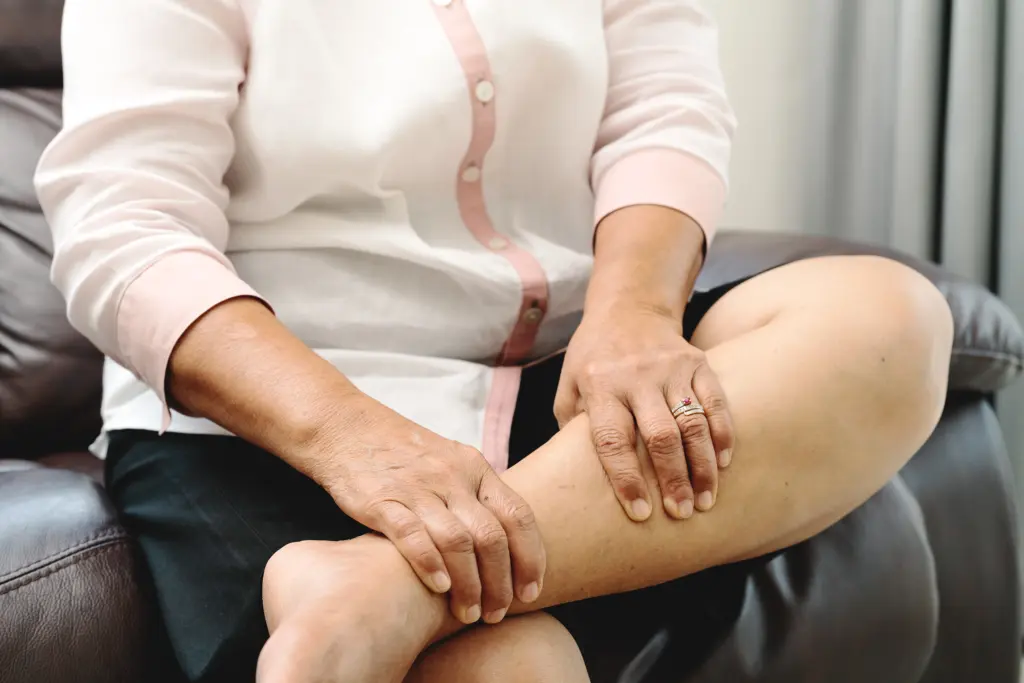 Leg swelling beyond DVT: Lymphedema, veins, heart, or kidneys 1 Leg swelling beyond DVT: Lymphedema, veins, heart, or kidneys