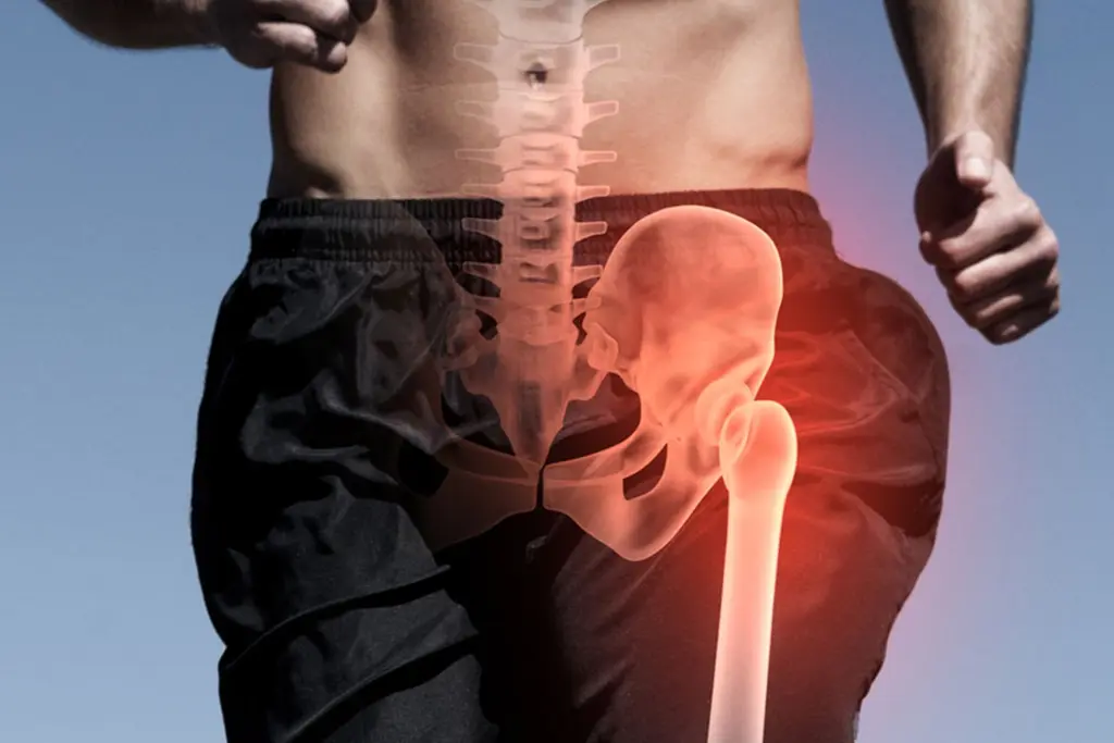 Sports-related hip pain: Top injuries you should know