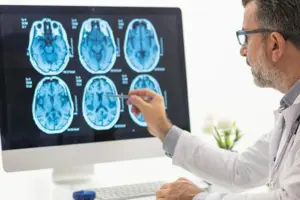 Untreated sleep apnea tied to brain microbleeds, potentially higher dementia risk: Study