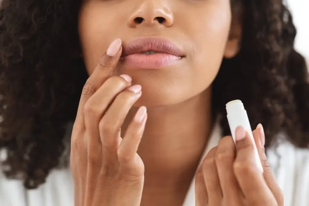 Winter skincare: Dermatologist advice for chapped lips and cracked heels
