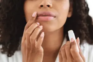 Winter skincare: Dermatologist advice for chapped lips and cracked heels
