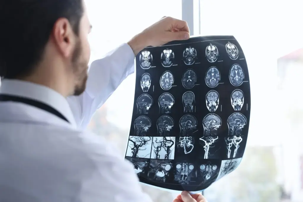 AIIMS Delhi completes India’s first clinical trial of homegrown ‘Supernova’ stroke stent