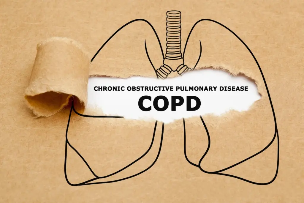 Early COPD symptoms you shouldn’t ignore 1 Early COPD symptoms you shouldn’t ignore