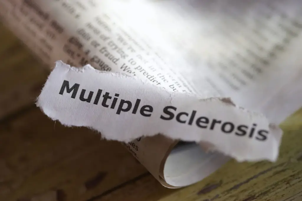 Scientists find two distinct forms of multiple sclerosis with AI technology