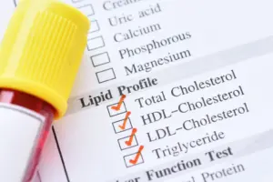 How often should you check your cholesterol An age-wise screening guide