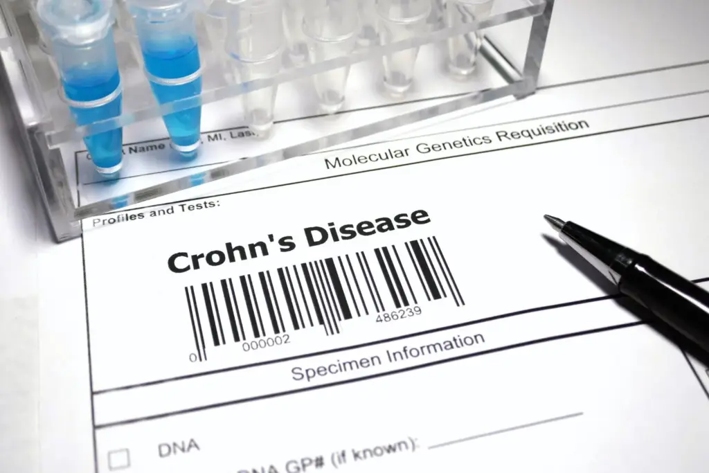 Eating within an 8-hour window eased Crohn’s symptoms in small trial