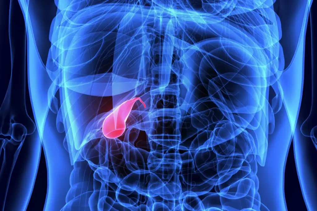 Silent gallstones Should you worry if your ultrasound finds stones but you have no pain