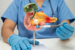 FDA clears limited early access to daraxonrasib for pancreatic cancer
